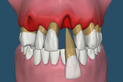 Gums & Bone Diseases at Mukhil General and Dental Clinic, Madurai